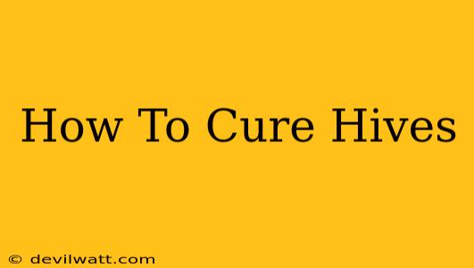 How To Cure Hives