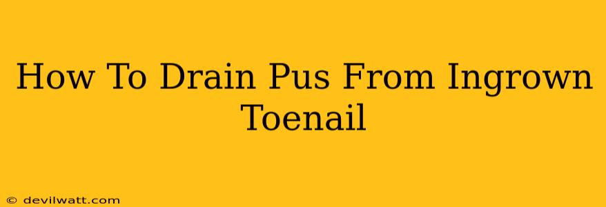 How To Drain Pus From Ingrown Toenail