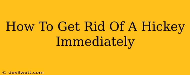 How To Get Rid Of A Hickey Immediately