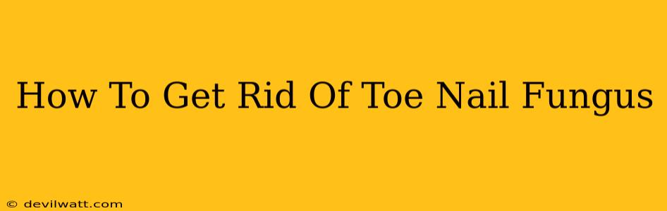 How To Get Rid Of Toe Nail Fungus