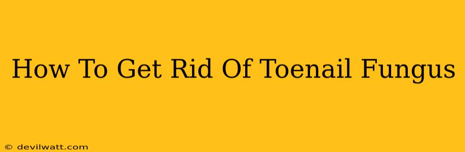 How To Get Rid Of Toenail Fungus