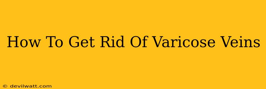 How To Get Rid Of Varicose Veins