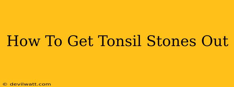 How To Get Tonsil Stones Out