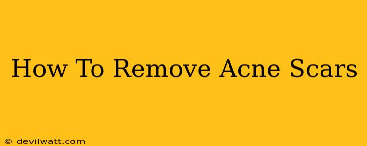 How To Remove Acne Scars