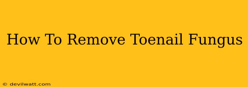 How To Remove Toenail Fungus