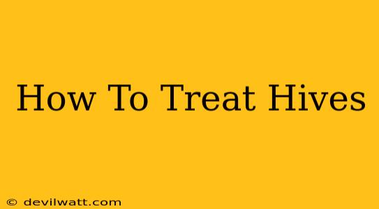 How To Treat Hives