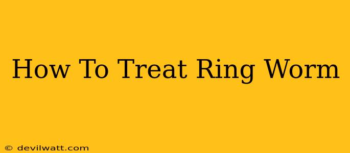 How To Treat Ring Worm